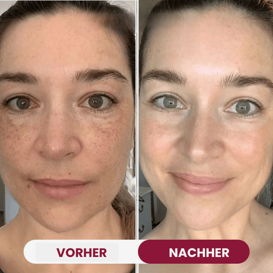 Masqur Bio-Collagene -  ILLORYA